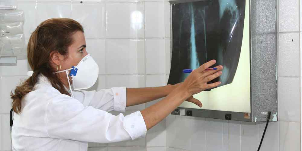 Governo Federal lança Plano Nacional Pelo Fim da Tuberculose