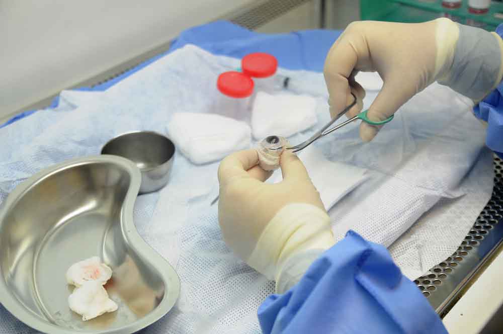 Doação de córneas em alta possibilita mais de 100 transplantes em 2022