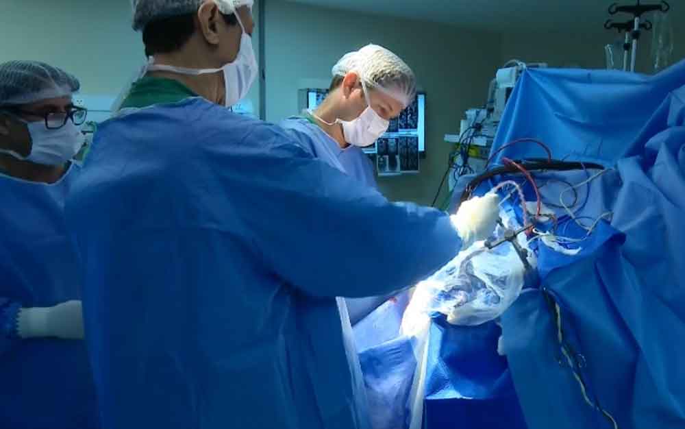 Hecad realiza 1ª cirurgia de separação de gêmeas siamesas