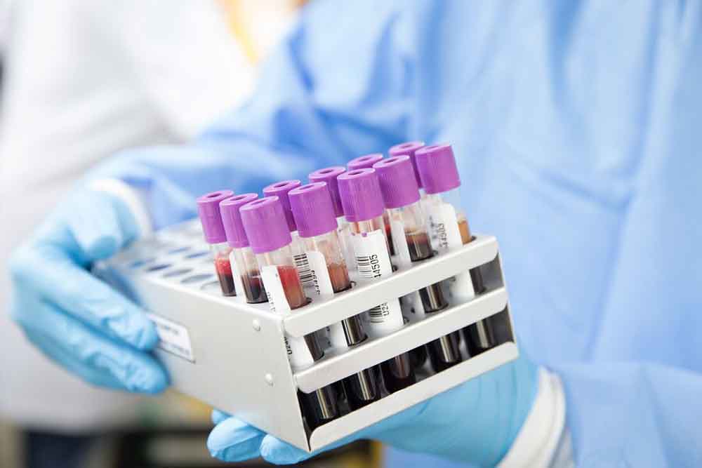 Diagnóstico de varíola dos macacos será feito nos Lacens até agosto