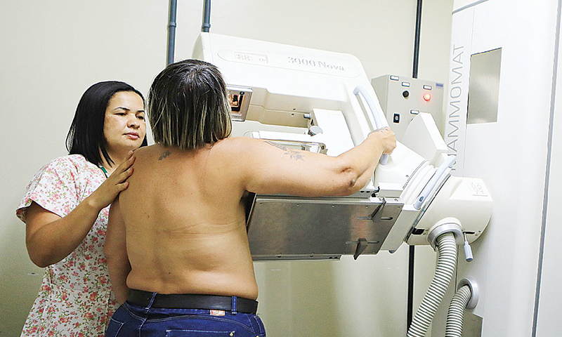 Governo amplia mamografias para zerar fila de espera