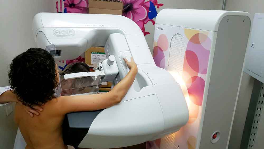 Goiás inicia teste genético para câncer de mama