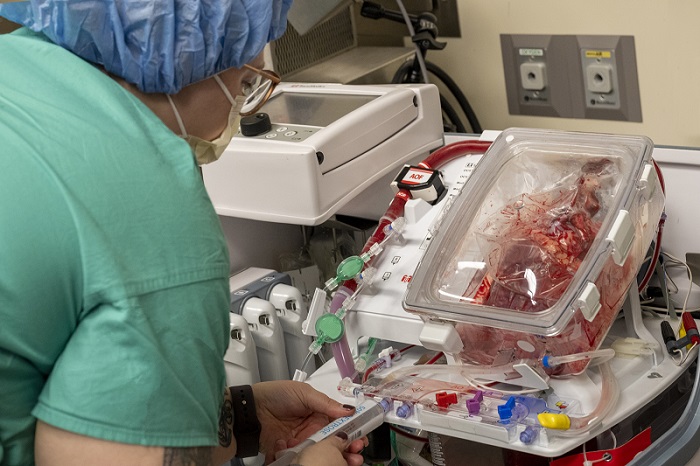 Nova tecnologia mantém órgão vivo fora do corpo do doador; entenda