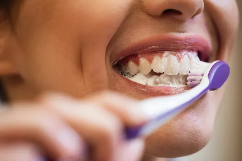 O erro comum na escovação que pode levar à perda de dentes, alerta dentista