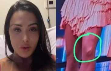 Gracyanne Barbosa se emociona ao falar sobre saída do ‘Dança dos famosos’ por lesão e ganha apoio de famosos