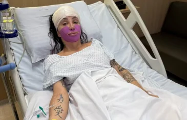 Maya Massafera detalha nova cirurgia no maxilar; relembre todas as intervenções feitas desde o início da transição