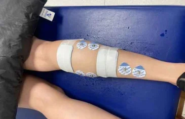 Distrito Federal investe em novos protocolos de eletroestimulação para reduzir fadiga muscular