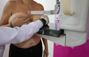 Sancionada lei que garante mamografia pelo SUS a mulheres a partir de 40 anos