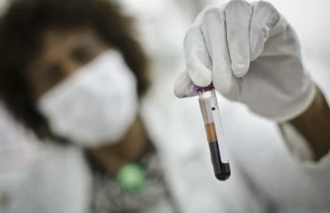 Saúde fortalece combate à leucemia no DF com diagnóstico rápido e tratamento especializado