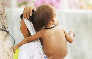 Vulnerabilidade social afeta crescimento de crianças indígenas e nordestinas